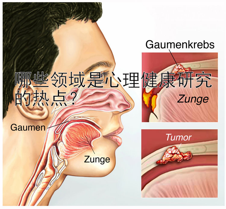 哪些领域是心理健康研究的热点？