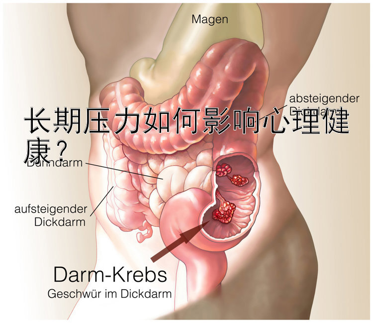 长期压力如何影响心理健康？