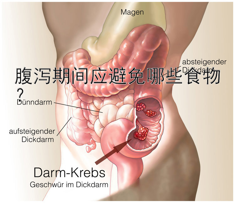 腹泻期间应避免哪些食物？