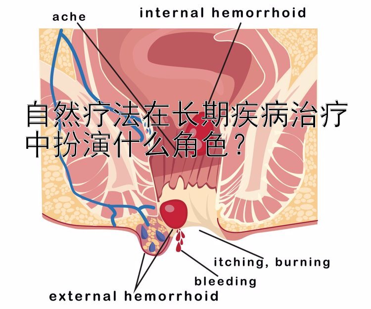 自然疗法在长期疾病治疗中扮演什么角色？