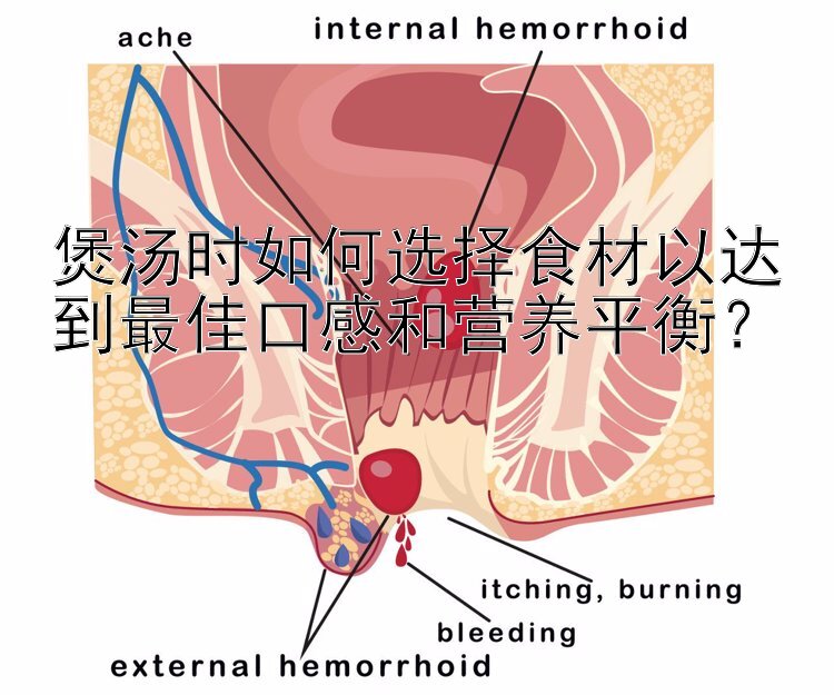 煲汤时如何选择食材以达到最佳口感和营养平衡？