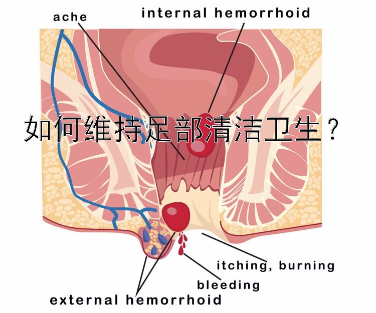 如何维持足部清洁卫生？