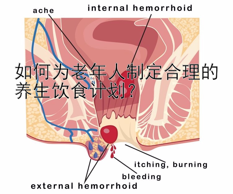 如何为老年人制定合理的养生饮食计划？