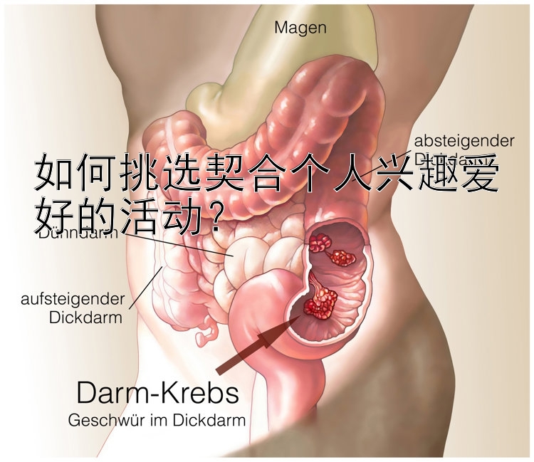 如何挑选契合个人兴趣爱好的活动？