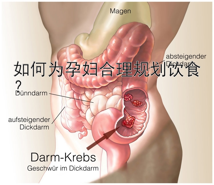 如何为孕妇合理规划饮食？