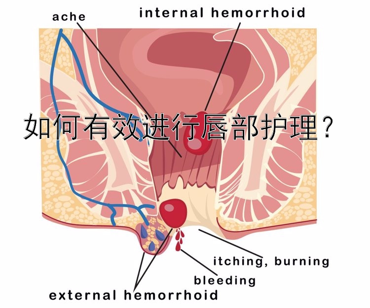 如何有效进行唇部护理？