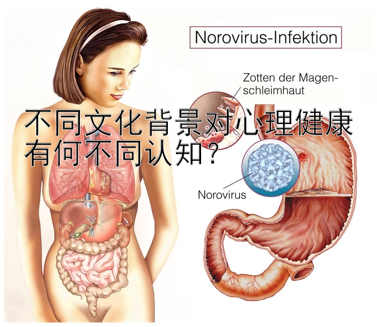 不同文化背景对心理健康有何不同认知？