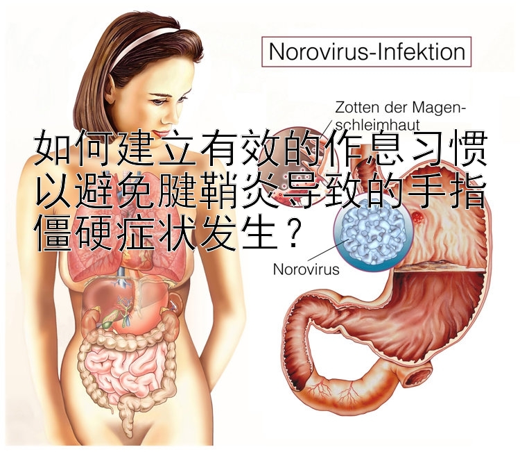 如何建立有效的作息习惯以避免腱鞘炎导致的手指僵硬症状发生？