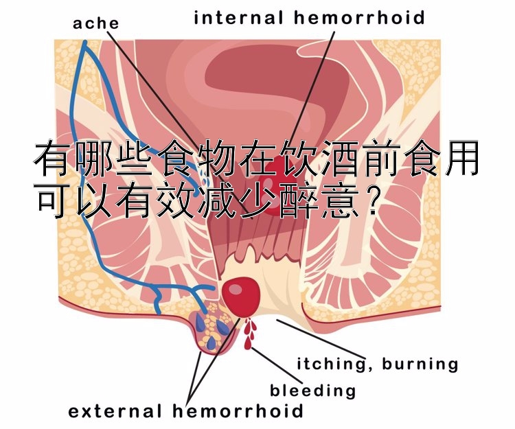 有哪些食物在饮酒前食用可以有效减少醉意？