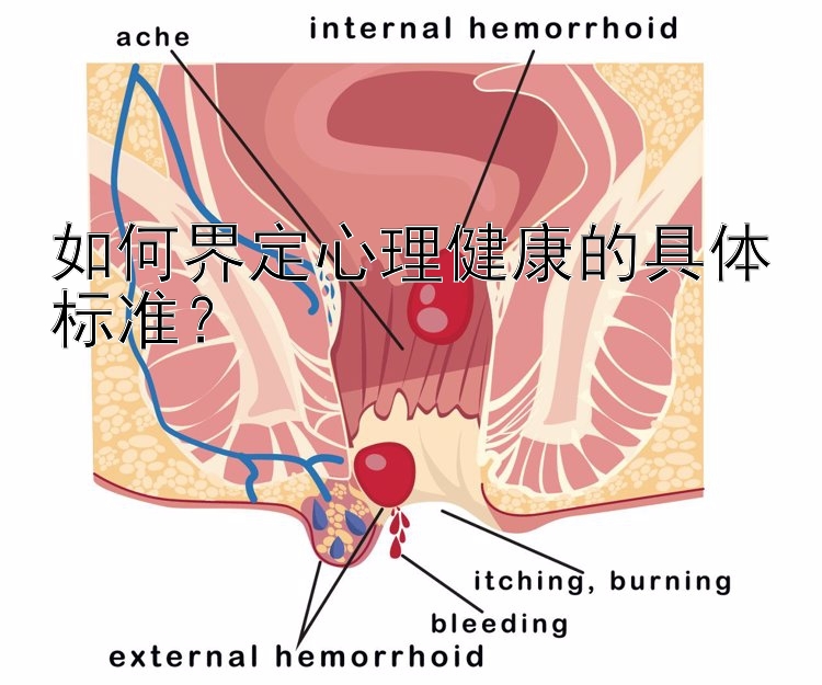 如何界定心理健康的具体标准？