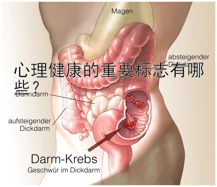 心理健康的重要标志有哪些？