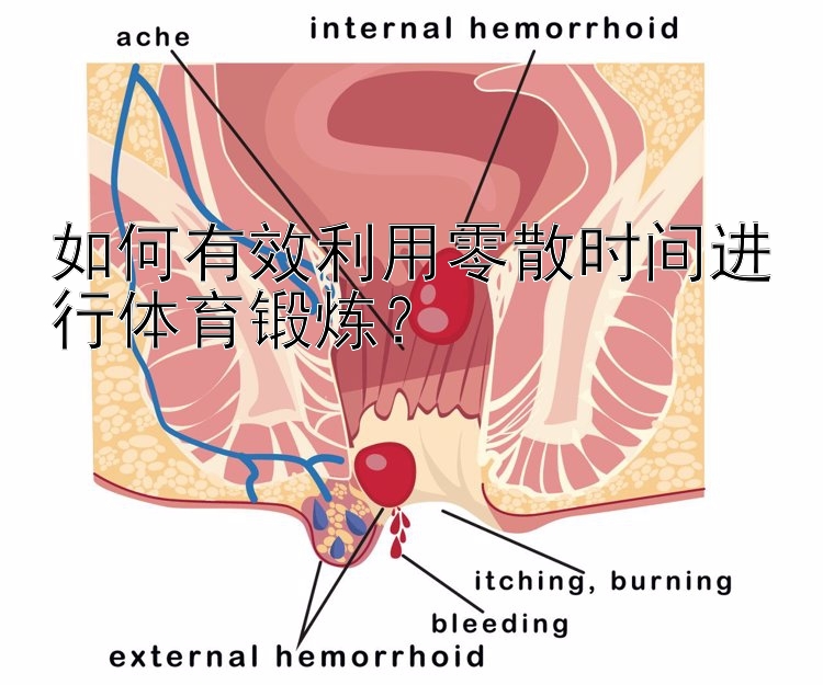 如何有效利用零散时间进行体育锻炼？