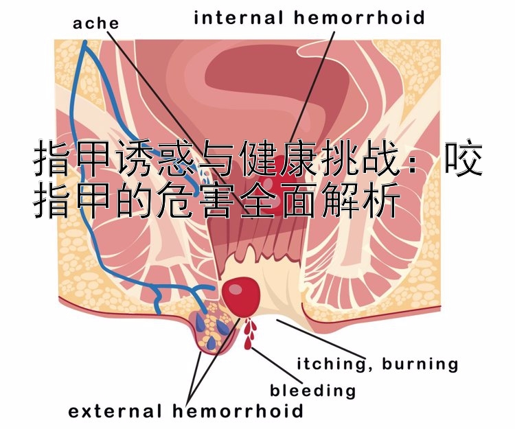 指甲诱惑与健康挑战：咬指甲的危害全面解析