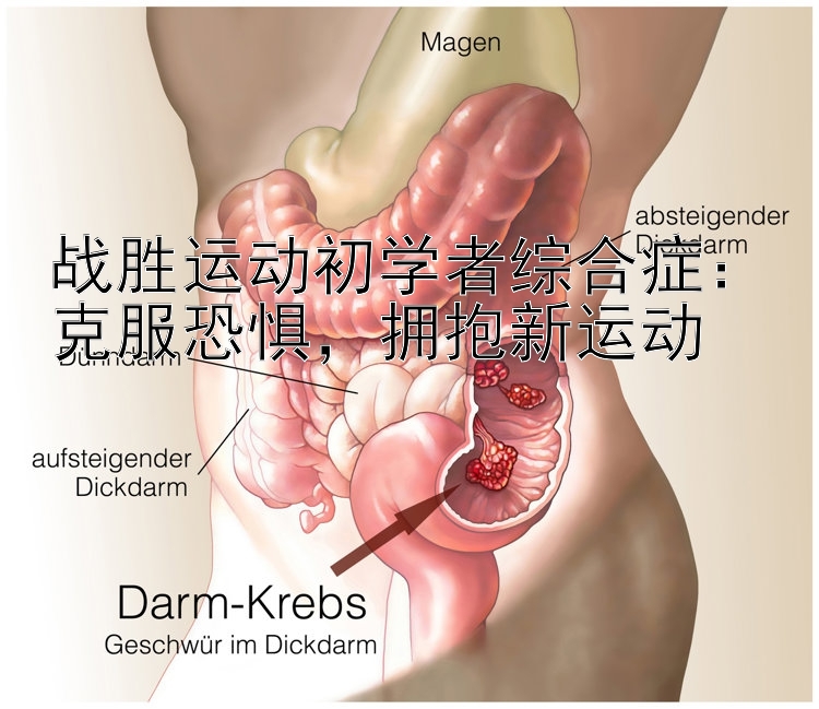 战胜运动初学者综合症：克服恐惧，拥抱新运动