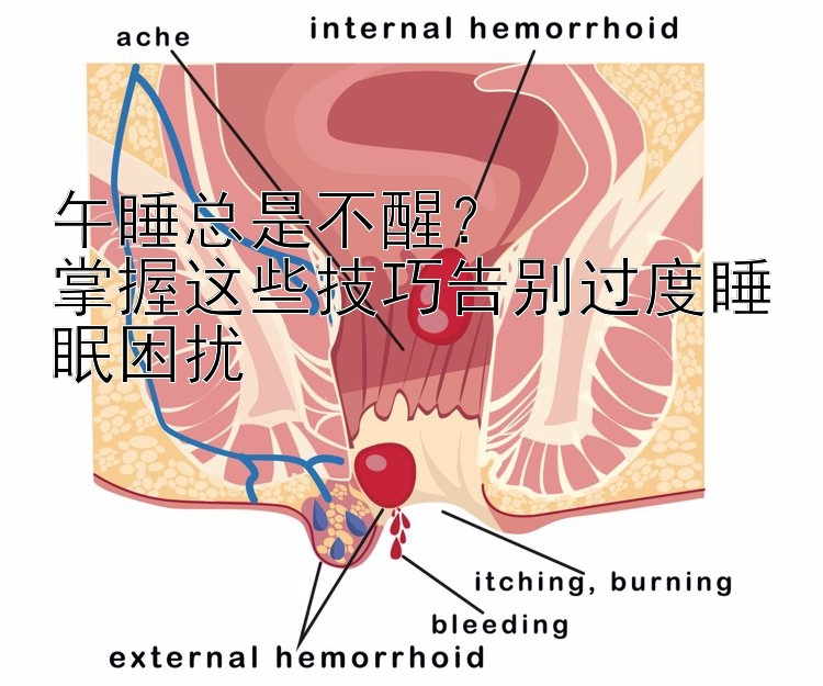 午睡总是不醒？  
掌握这些技巧告别过度睡眠困扰