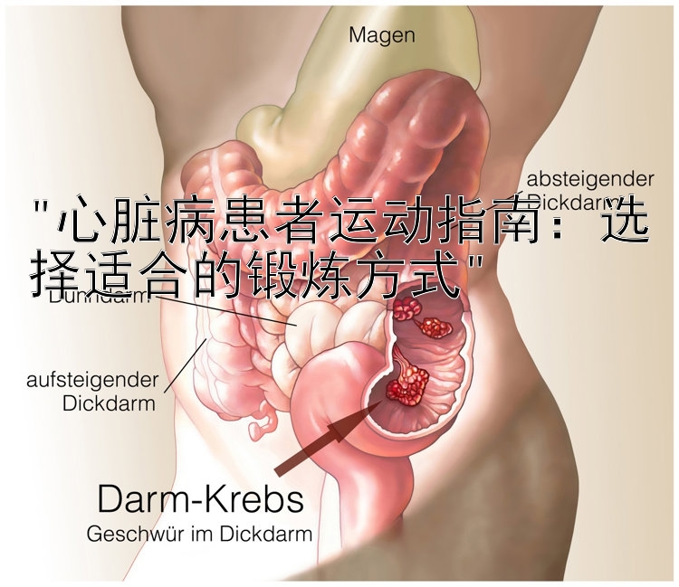 心脏病患者运动指南：选择适合的锻炼方式